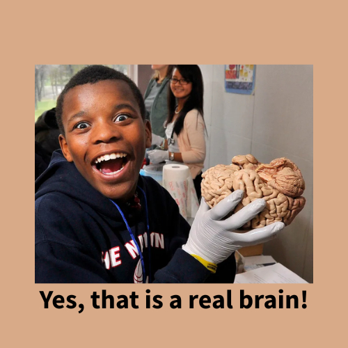 Yes that is a real brain!
